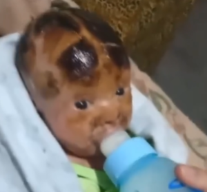 Bebê com doença rara precisa de tratamento