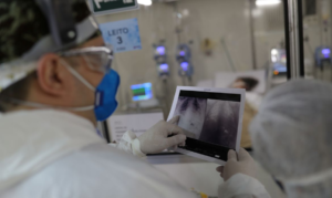 O que é broncopneumonia, doença que levou Bolsonaro à UTI