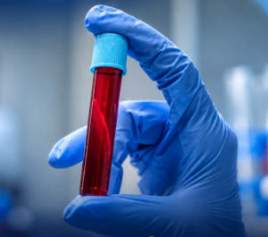 Exame de sangue que busca sinais de mais de 50 tipos de câncer chega ao Brasil; veja preço e limitações